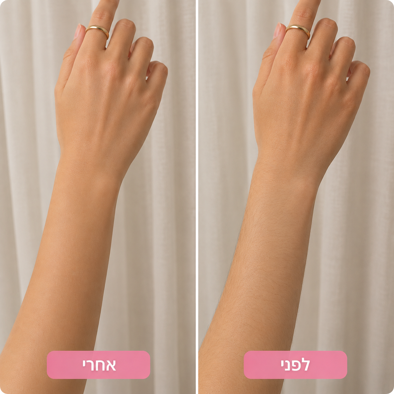 מוחק השיער של TORIA
