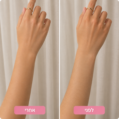 מוחק השיער של TORIA